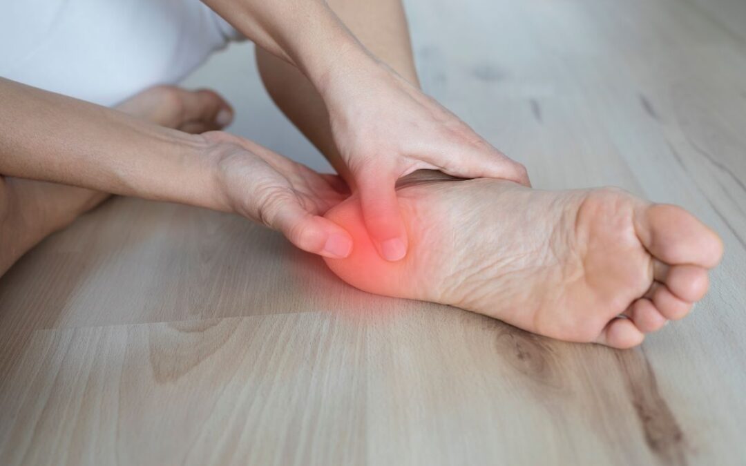 La tallonite o Flogosi Calcaneare, cause e terapia